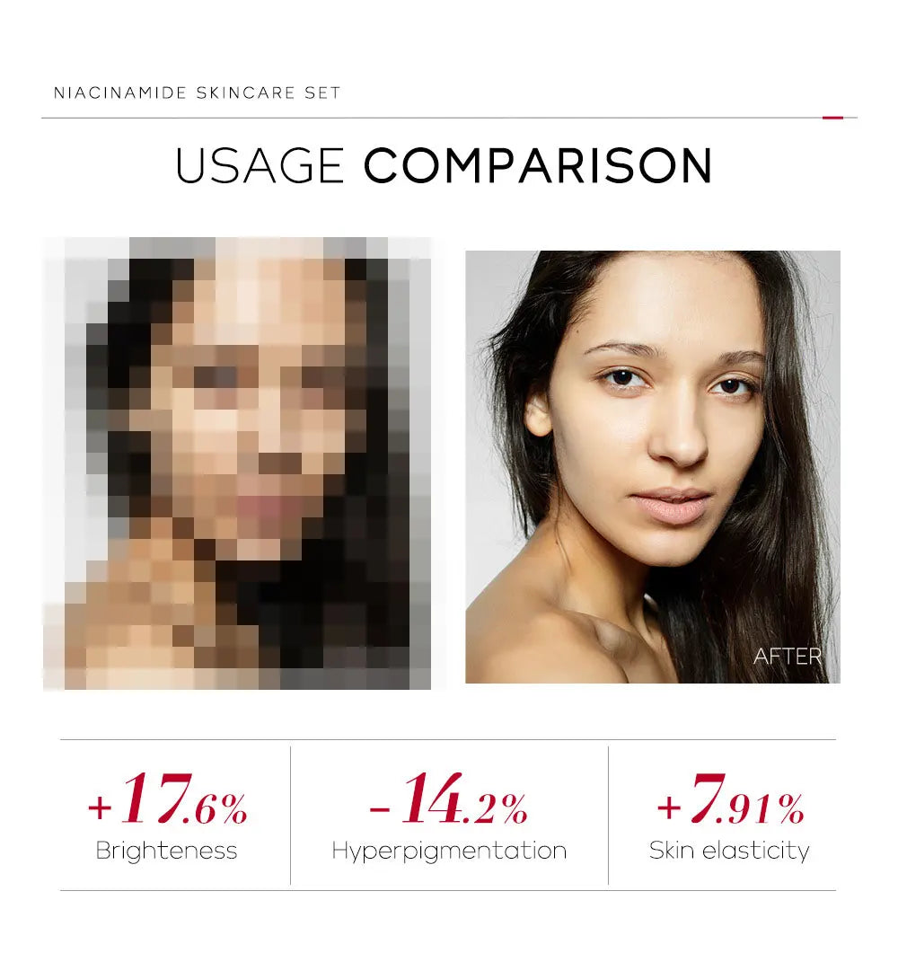 Niacinamide Recovery System